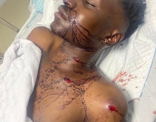 Miracle Survival: Telvin Fights for His Life After Zimmerman Shooting